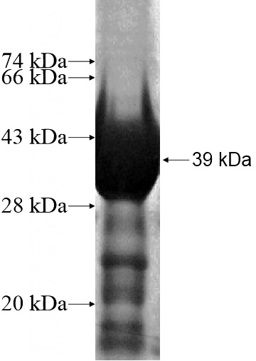 Recombinant Human ZNF346 SDS-PAGE