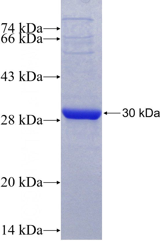 Recombinant Human ABCC2 SDS-PAGE