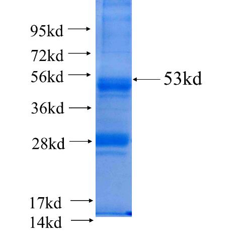 Recombinant human RND3(Full length) SDS-PAGE