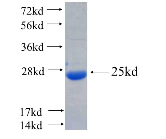 Recombinant human NAV1 SDS-PAGE