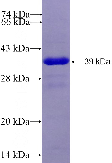 Recombinant Human PPA2 SDS-PAGE