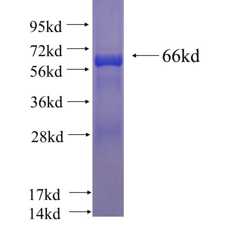 Recombinant human GNAI1 SDS-PAGE