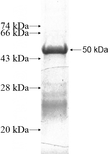 Recombinant Human RHOJ SDS-PAGE