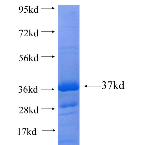 Recombinant human FBXO17(Full length) SDS-PAGE