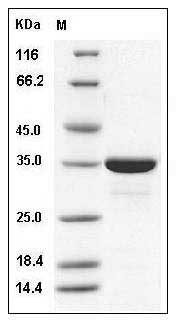 Human ACYP2 / Acylphosphatase-2 Protein (GST Tag) SDS-PAGE