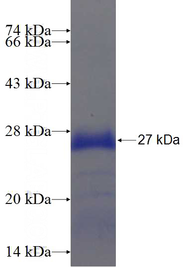 Recombinant Human C2orf51 SDS-PAGE