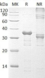 Human UBE2R2/CDC34B/UBC3B (His tag) recombinant protein