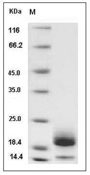 Mouse Cystatin E / CST6 Protein (His Tag) SDS-PAGE