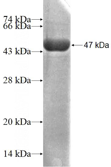 Recombinant Human AP1G2 SDS-PAGE