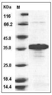 Human BNIP3L Protein SDS-PAGE