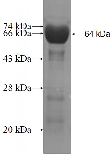 Recombinant Human SPAG5 SDS-PAGE
