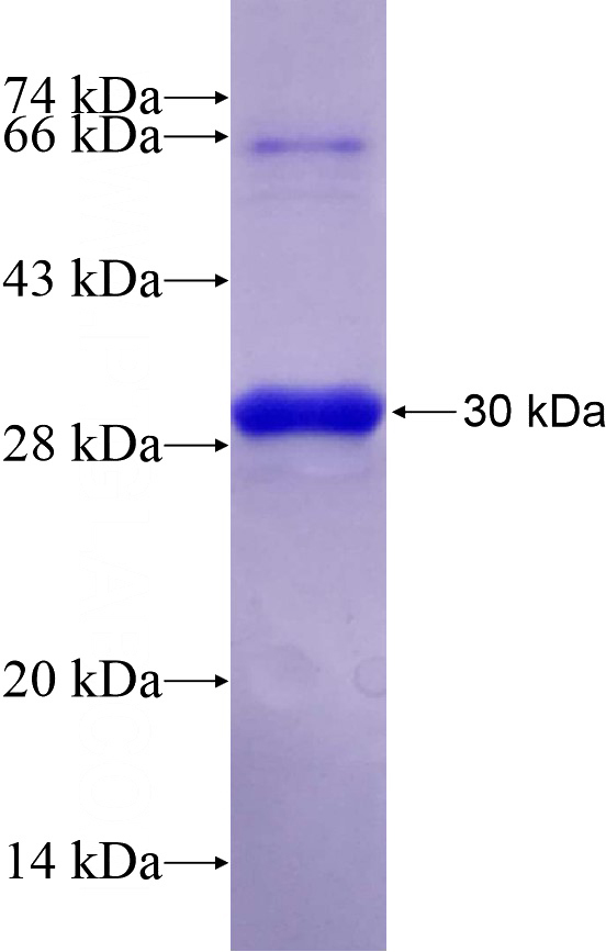 Recombinant Human DUSP11 SDS-PAGE
