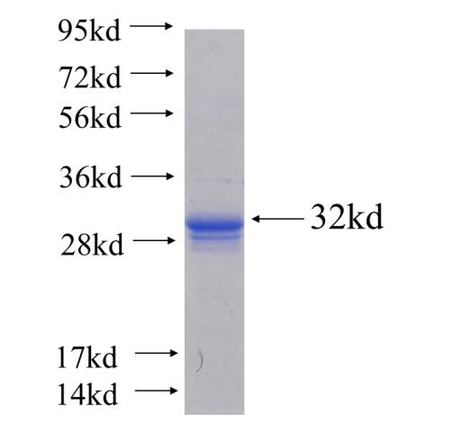 Recombinant human CENPA SDS-PAGE