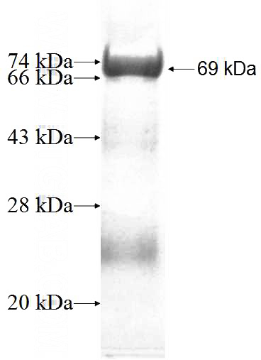 Recombinant Human DTNBP1 SDS-PAGE