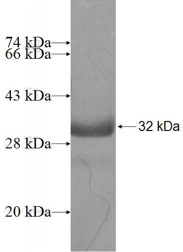 Recombinant Human NT5C3L SDS-PAGE