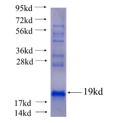 Recombinant human CHURC1(Full length) SDS-PAGE