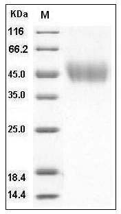Human CD80 / B7-1 Protein (His Tag) SDS-PAGE