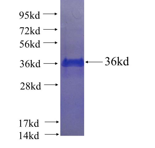 Recombinant human RHBDD1 SDS-PAGE