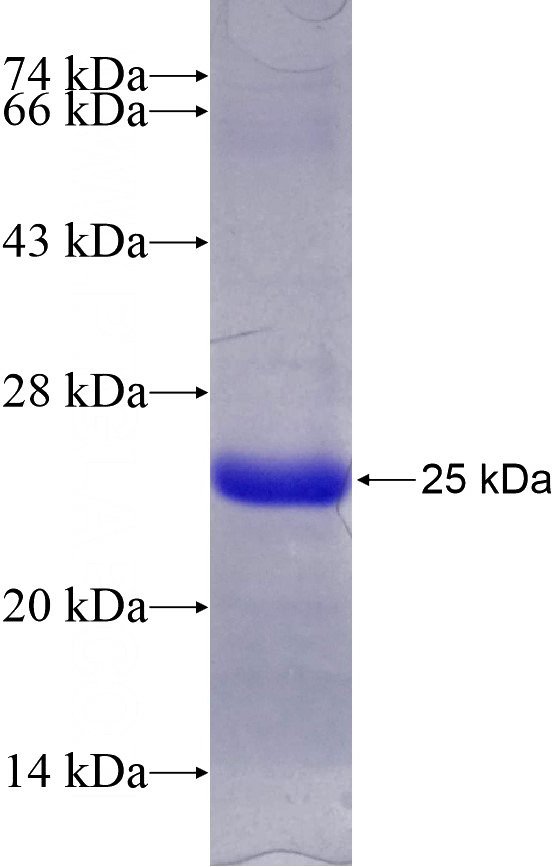 Recombinant Human ARF5 SDS-PAGE
