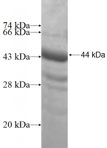 Recombinant Human ROD1 SDS-PAGE