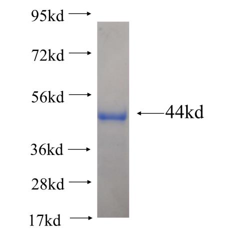Recombinant human RASIP1 SDS-PAGE