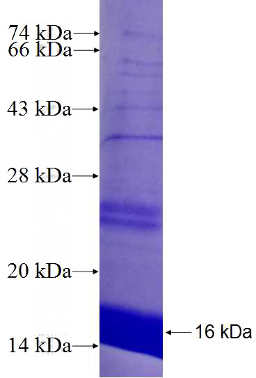 Recombinant Human COMMD6 SDS-PAGE