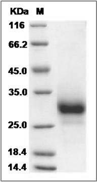 Human TNFRSF19 / TROY Protein (His Tag) SDS-PAGE