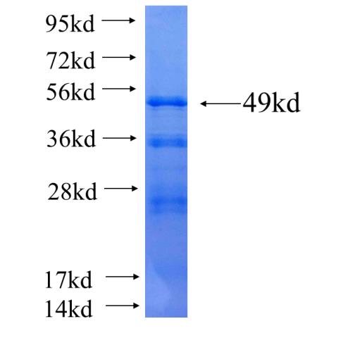 Recombinant human NR2F6(Full length) SDS-PAGE