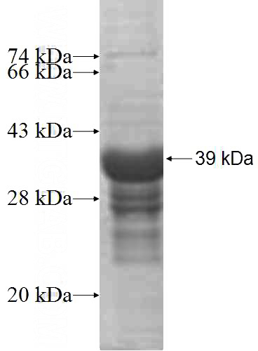 Recombinant Human YIPF4 SDS-PAGE
