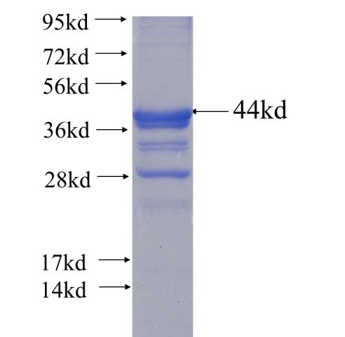 Recombinant human CGNL1 SDS-PAGE