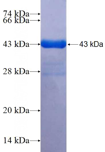 Recombinant Human MYL12A SDS-PAGE