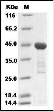 Human IL18 / Interleukin 18 / IGIF Protein (GST Tag) SDS-PAGE