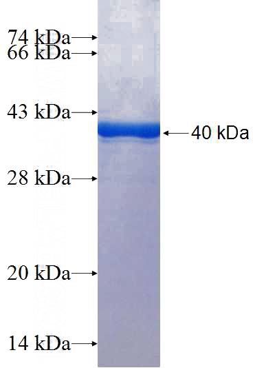 Recombinant Human Filaggrin SDS-PAGE