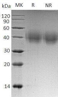 Mouse Slamf6/Ly108 (His tag) recombinant protein
