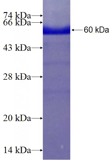 Recombinant Human ASRGL1 SDS-PAGE