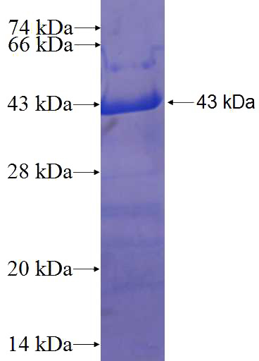 Recombinant Human EFCAB6 SDS-PAGE