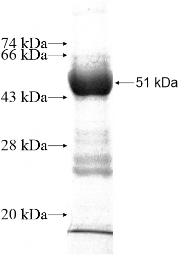 Recombinant Human MOBKL2B SDS-PAGE