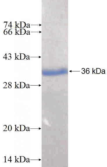 Recombinant Human RHOU SDS-PAGE