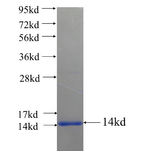 Recombinant human TMIE SDS-PAGE