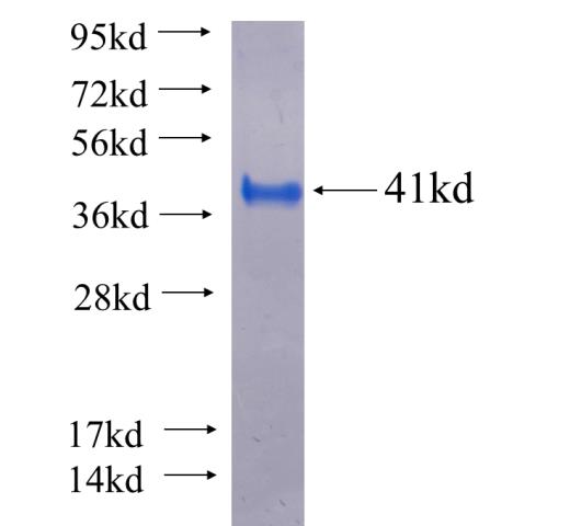 Recombinant human SH2D1B SDS-PAGE