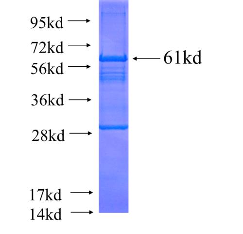 Recombinant human TTC8 SDS-PAGE