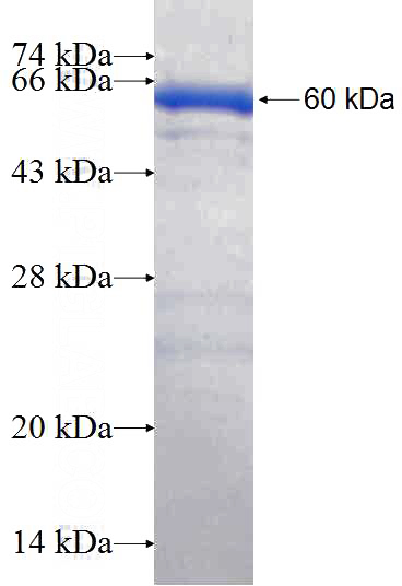 Recombinant Human ARIH1 SDS-PAGE
