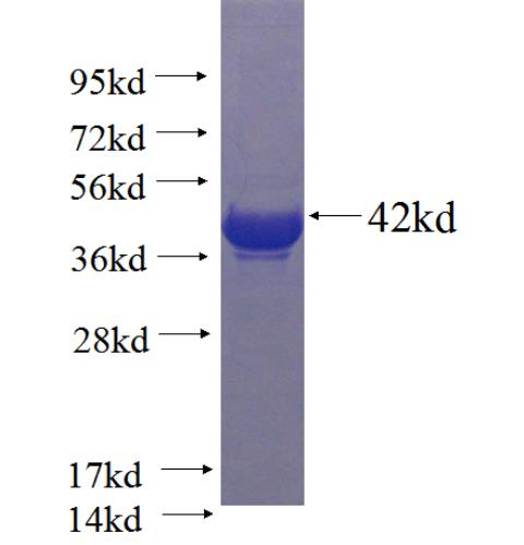 Recombinant human PIK3C2G SDS-PAGE