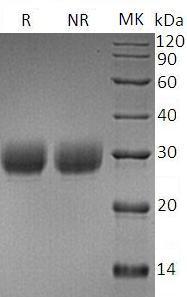 Mouse Apcs/Ptx2/Sap (His tag) recombinant protein
