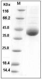 Human KLK11 / Kallikrein-11 Protein (His Tag) SDS-PAGE