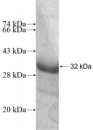 Recombinant Human ARD1B SDS-PAGE