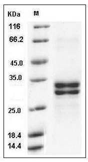 Human HMGB1 / HMG1 Protein (His Tag) SDS-PAGE