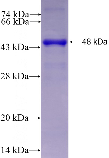 Recombinant Human ESRP1 SDS-PAGE