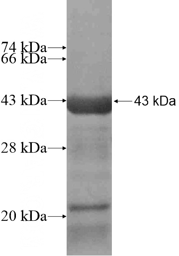 Recombinant Human AMDHD1 SDS-PAGE