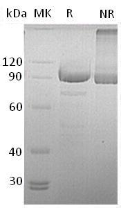 Human PCDH10/KIAA1400 (His tag) recombinant protein